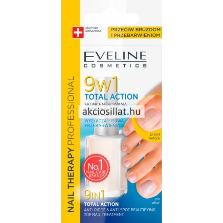 Eveline Nail Therapy 9in1 lábköröm erősítő 12ml