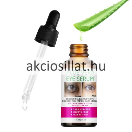 Lora Aloe Vera Eye Serum Aloe Vera Szemkörnyékápló Szérum 30ml