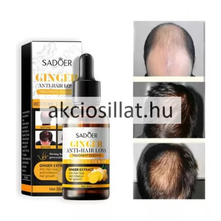 Sadoer Ginger Hajhullás Elleni szérum 30ml