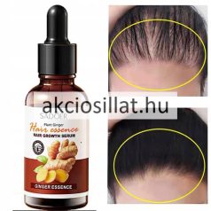  Sadoer Ginger Essence Hair Growth Serum Hajnövekedés szérum 30ml