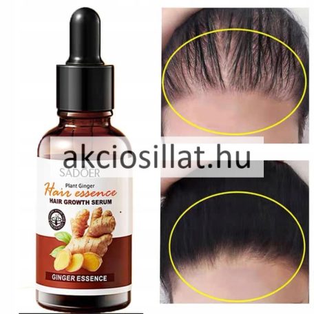 Sadoer Ginger Essence Hair Growth Serum Hajnövekedés szérum 30ml