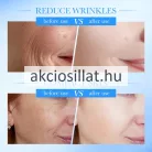 Sadoer Anti-Wrinkle 3x Collagen Retinol Peptides Cream Ránctalanító krém 50g