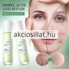 Sadoer Salicylic Acid Acne 3% Lotion Szalicilsavas Akne Elleni Arcápoló 100ml