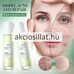   Sadoer Salicylic Acid Acne 3% Lotion Szalicilsavas Akne Elleni Arcápoló 100ml