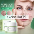 Sadoer Salicylic Acid 3% Szalicilsavas Akne Elleni Arckrém 50g