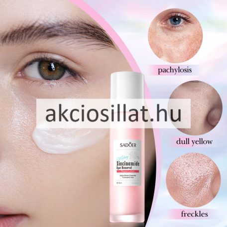Sadoer Niacinamid 10% Folteltávolító Regeneráló Testápoló 100ml