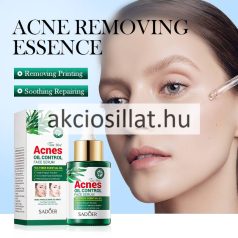   Sadoer Tea Tree Acnes Oil Control Face Serum pattanás elleni arcszérum 30ml