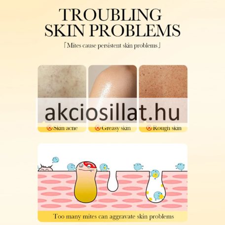 Sadoer Sulfur Soap Kénes szappan 100g