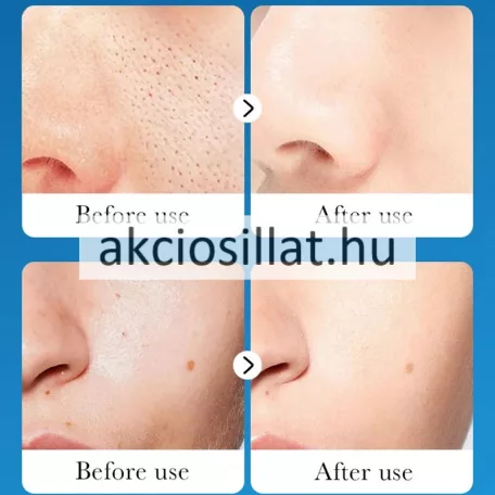 Sadoer Peel-Off Mask Dead Sea Mud + Rich Minerals Lehúzható Arcmaszk Holt Tengeri Ásványokkal 100g